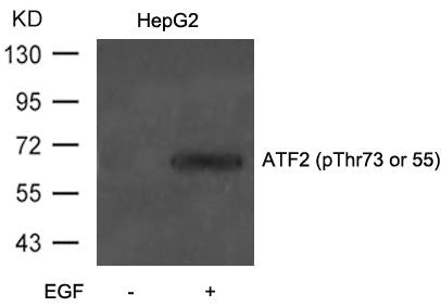 Phospho-ATF2 (Thr73 or 55) Antibody