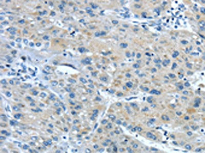 TNIP1 Antibody