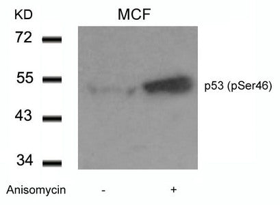 Phospho-TP53 (Ser46) Antibody