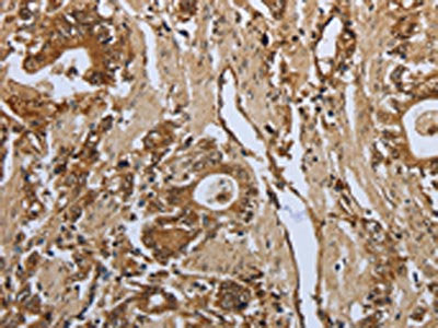 PPARA Antibody