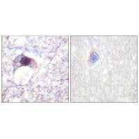 E2F6 Antibody