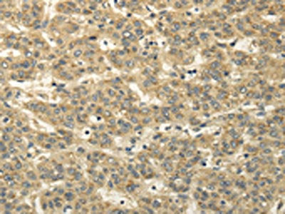 TBC1D22A Antibody