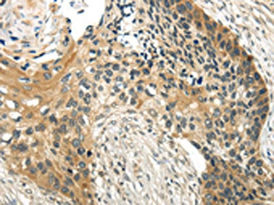 WDR36 Antibody