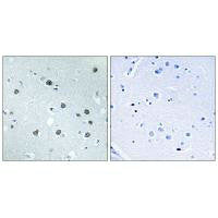 MYO1D Antibody