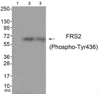 Phospho-FRS2 (Tyr436) Antibody