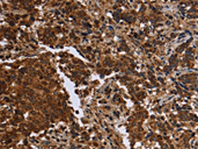 FMN2 Antibody