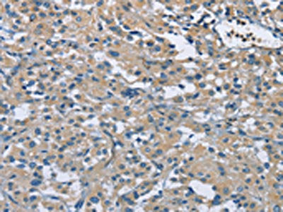 ZMYND11 Antibody