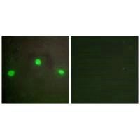 ATRX Antibody
