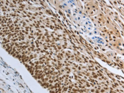 PRMT3 Antibody