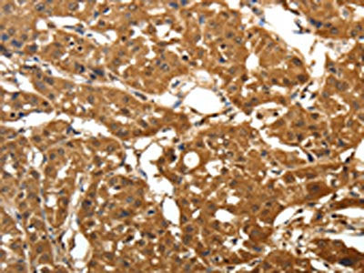 PARK7 Antibody