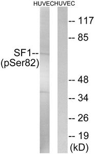 Phospho-SF1 (Ser82) Antibody