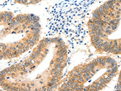 SIPA1 Antibody