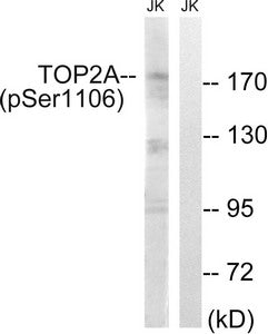 Phospho-TOP2A (Ser1106) Antibody