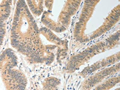 MAP4K5 Antibody