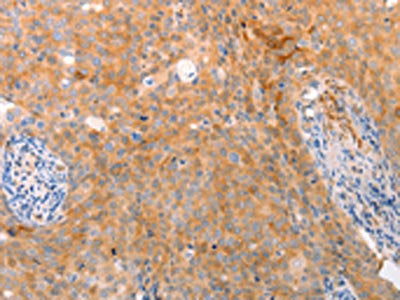ABCA2 Antibody