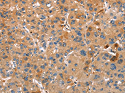 PLIN2 Antibody