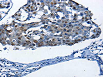 BPIFB1 Antibody