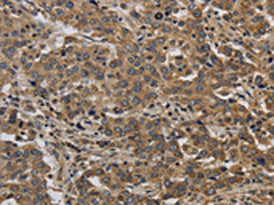 KIF4A Antibody