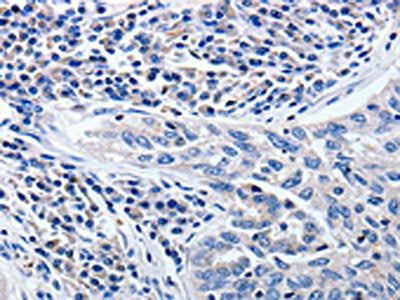 CCNE1 Antibody