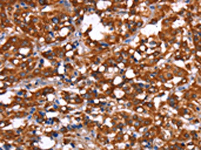 GAGE12I Antibody