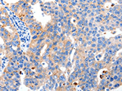 MAPK10 Antibody