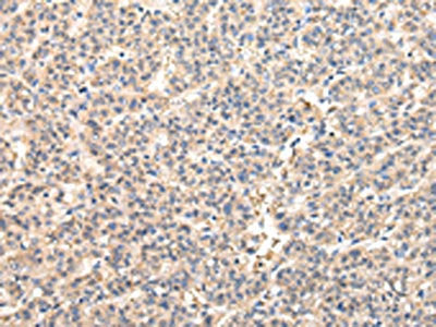 VPS45 Antibody