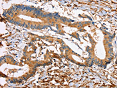 DPYSL2 Antibody