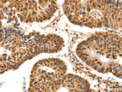 SPATA20 Antibody