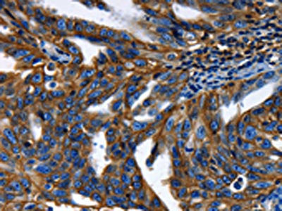 ABCC5 Antibody