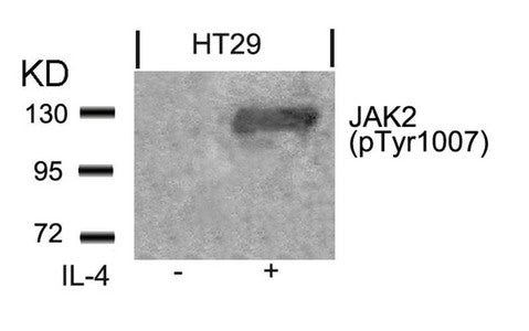 Phospho-JAK2 (Tyr1007) Antibody