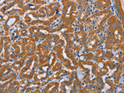 ALDH3A1 Antibody