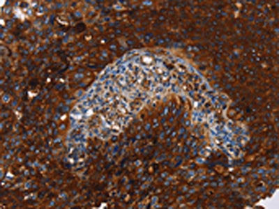 MSLN Antibody