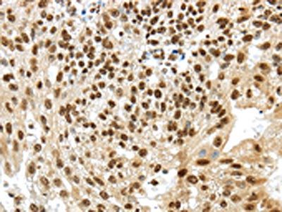 TRIM27 Antibody