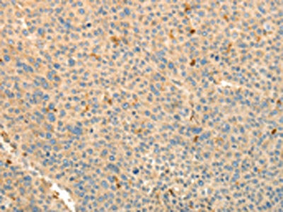 TMSB4X Antibody