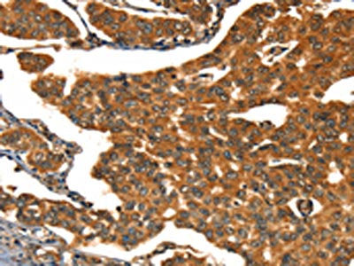 CACNA1E Antibody