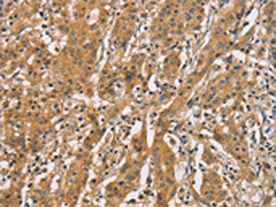 CDCP1 Antibody