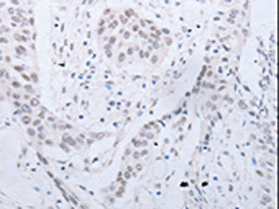CCND2 Antibody