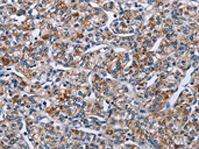 PLCL1 Antibody