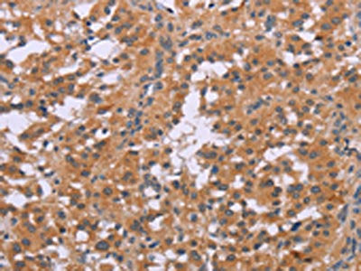 CDK1 Antibody