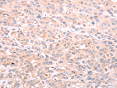 NFKBIE Antibody