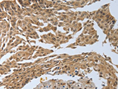PSMD6 Antibody