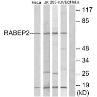 RABEP2 Antibody