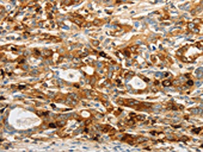 OASL Antibody