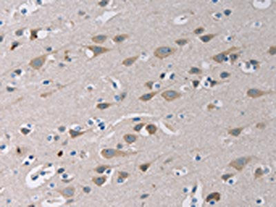 TLR1 Antibody