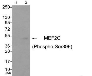 Phospho-MEF2C (Ser396) Antibody