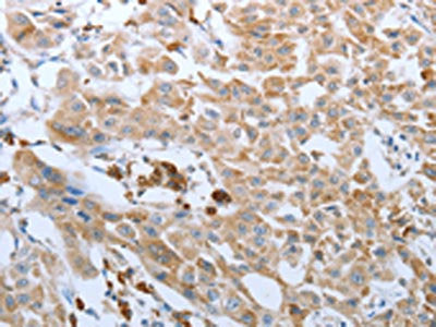 FGF1 Antibody