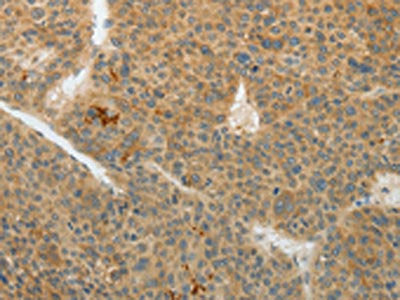 TEKT5 Antibody