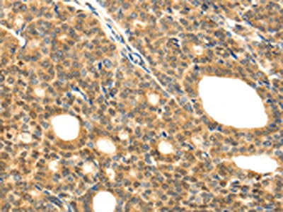 LYZ Antibody