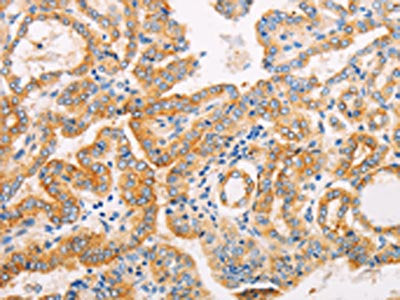 SUFU Antibody
