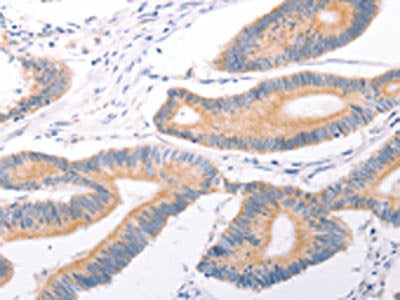 TRPC7 Antibody